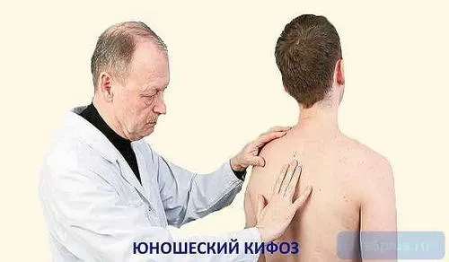 спина