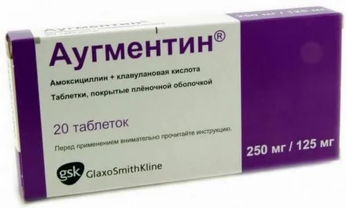 Якими антибіотиками лікувати фарингіт? можна вилікувати фарингіт без антибіотиків