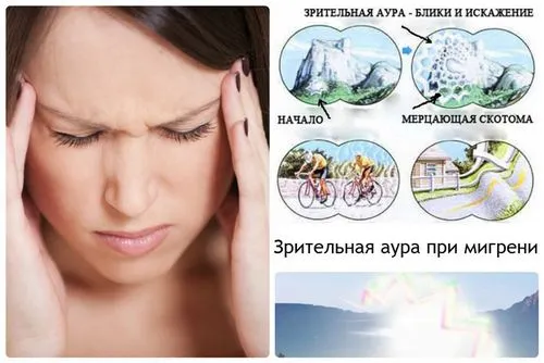 Симптоми і лікування мігрені мігрень