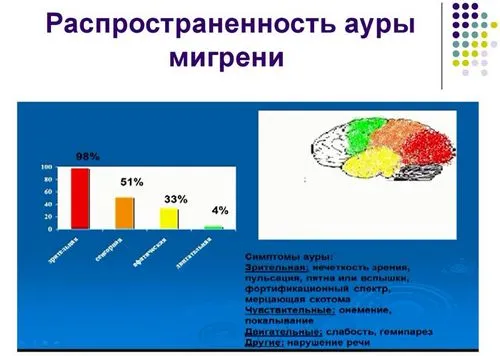 Симптоми і лікування мігрені мігрень