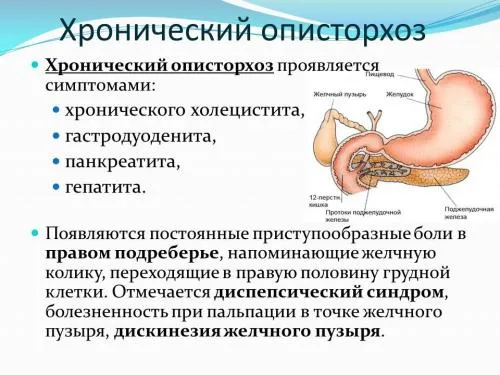 як лікувати опісторхоз більтріцідом