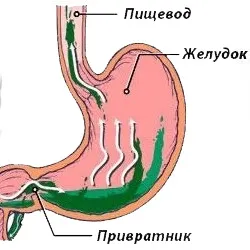 жовч в шлунку як лікувати народними засобами
