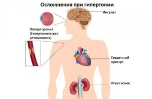 як лікувати тиск 140 на 90