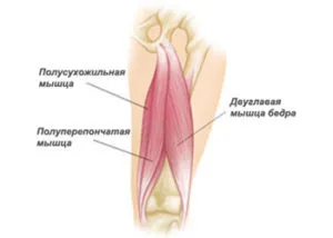 як лікувати розтягнення стегна