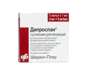 лікувати артроз кисті