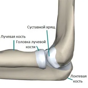 як лікувати бурсит ліктьового відростка