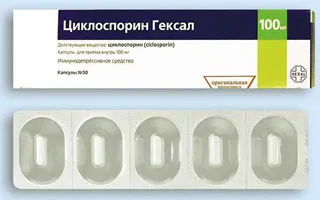 псоріаз