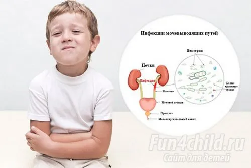цистит у хлопчиків