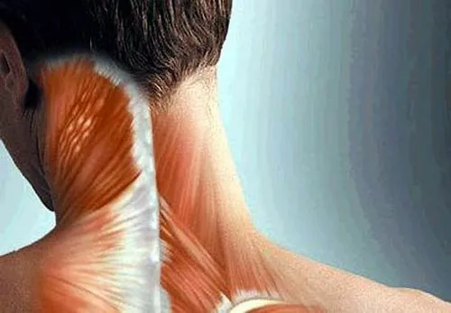 як лікувати м'язи спини