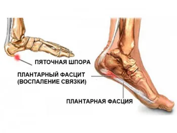 як лікують медичної жовчю