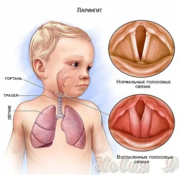 віруси