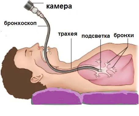 як лікувати постійну мокроту