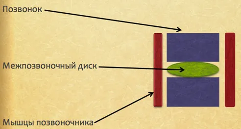 як лікувати гострий остеохондроз
