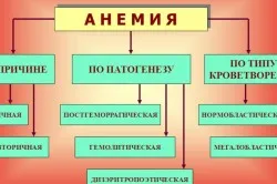 як лікувати анемію кінцівок