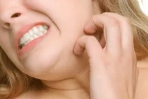 як лікувати псоріаз свербіж