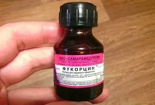 лікувати вітрянку без зеленки