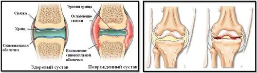 спорт і здоров'я