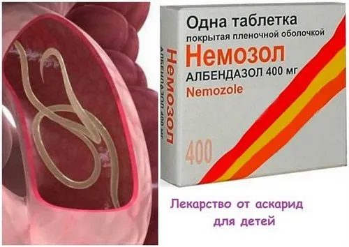 Аскариди у дитини: симптоми і лікування аскаридозу у дітей аскариди дитина аскаридоз симптоми лікування ознаки діти ліки профілактика лікувати