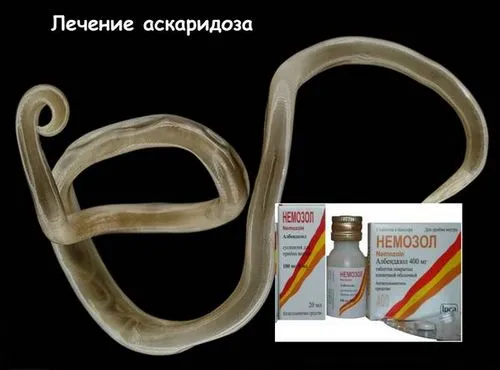 Аскариди у дитини: симптоми і лікування аскаридозу у дітей як лікувати лямблії і аскариди у дітей