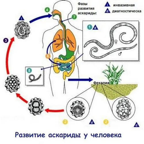 Аскариди у дитини: симптоми і лікування аскаридозу у дітей аскариди дитина аскаридоз симптоми лікування ознаки діти ліки профілактика лікувати