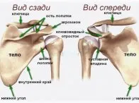 ніж лікувати невралгію плеча