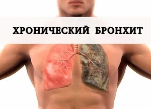 як вилікувати хронічний грип