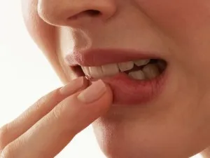 як лікувати сіли ясна