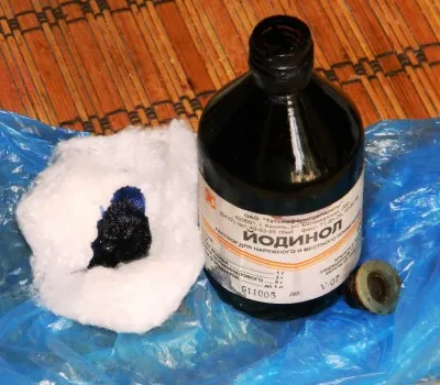 як лікувати стоматит йодинолом