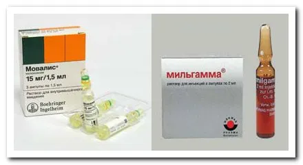 як лікувати радикуліт шиї