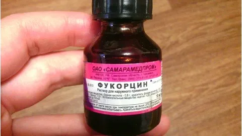 як вилікувати грибок нігтів за допомогою йоду