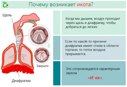 як лікувати гикавку у дорослого