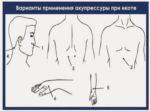 як позбутися від гикавки