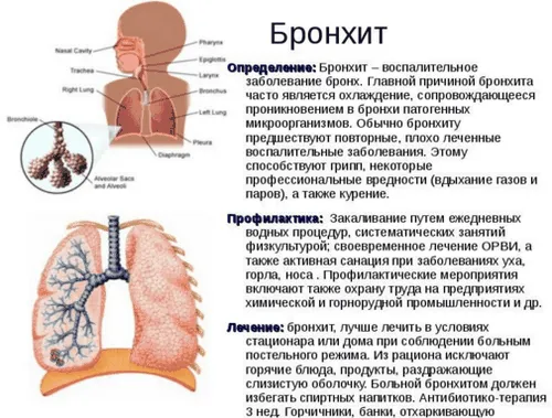 як лікувати бронхіт в домашніх умовах