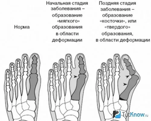 стопи