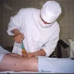 як лікувати кісту в коліні