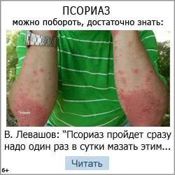 лікування псоріазу дьогтем