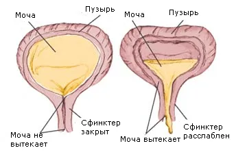 як лікувати ослаблений сечовий міхур