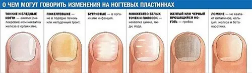 як вилікувати грибок нігтя мамі