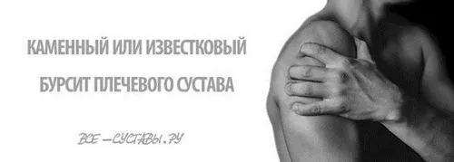 вапняний кам'яний бурсит плечового суглоба лікування симптоми