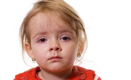 як лікувати халязион в однорічної дитини