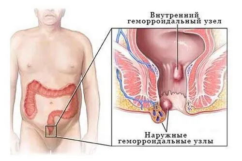 картопля