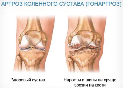 дієта