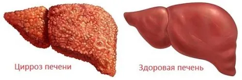 реально вилікувати печінку