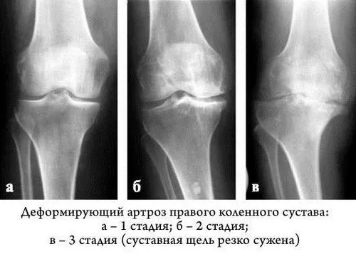 дієта