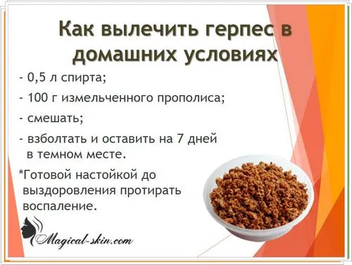 Невралгія після оперізуючого герпесу: реабілітація і лікування як лікувати невралгію після оперізуючого лишаю