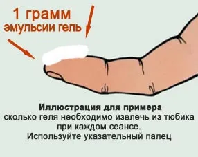 тріщина пряма кишка анальний лікувати симптом пологи