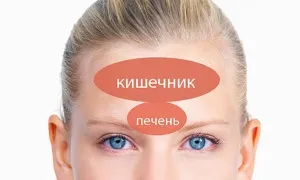 як позбутися від прищів на лобі