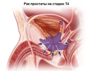 робот да Вінчі