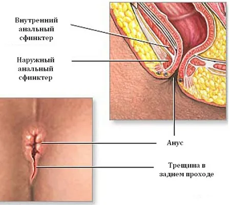 основні симптоми