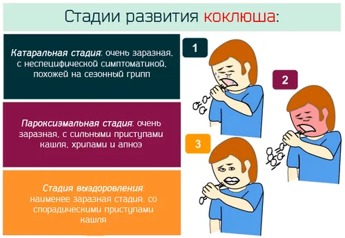 як лікувати коклюшний кашель